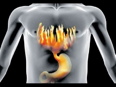 Sudden pressure or <b>chest</b> pain that accelerates. . Burning sensation in chest spiritual
